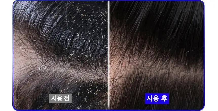 [정수리냄새 제거]헤드앤숄더 차콜 샴푸 800mL 상세페이지 9